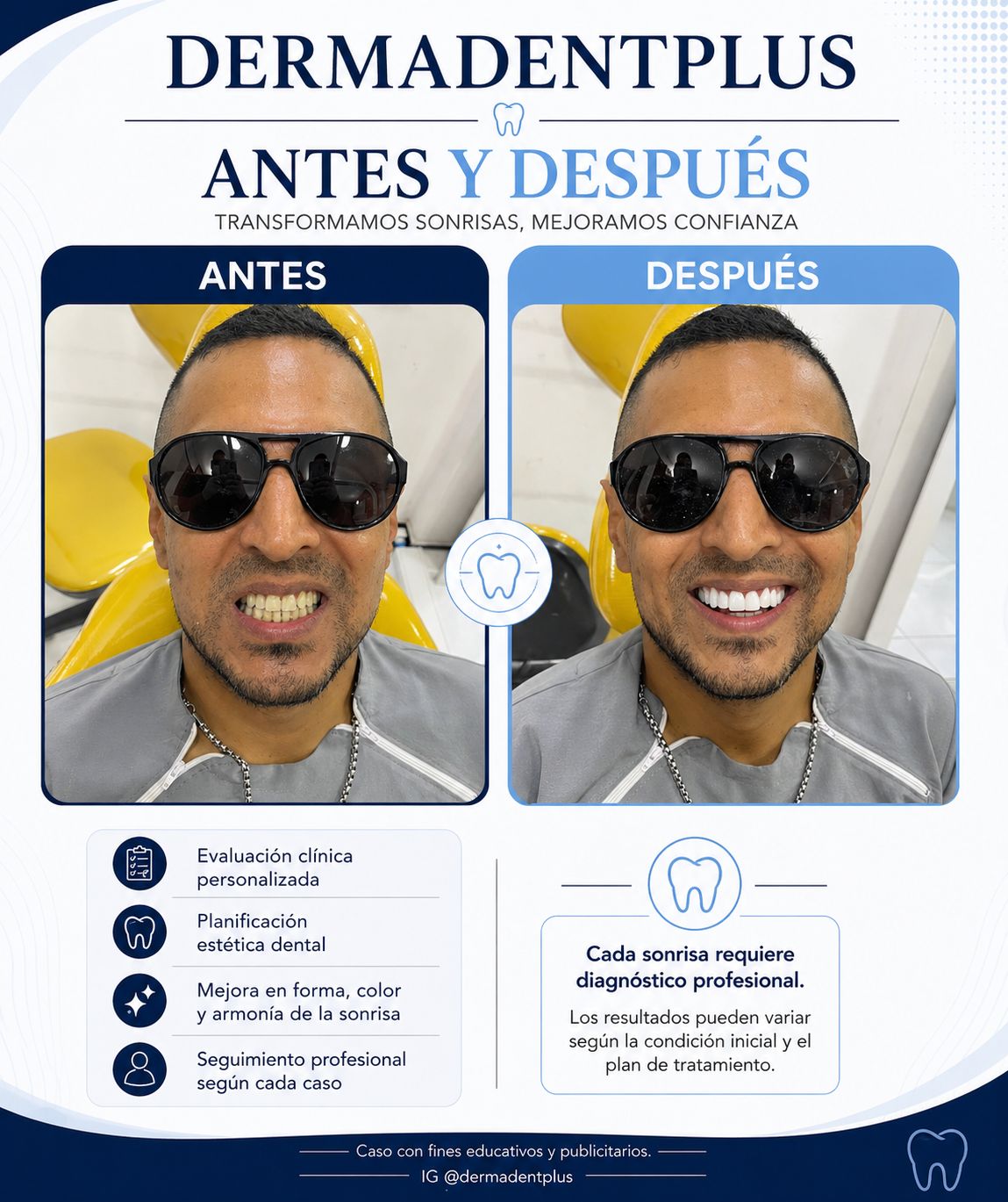 Antes y después DermadentPlus