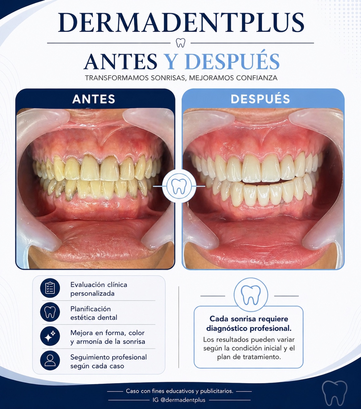 Antes y después DermadentPlus